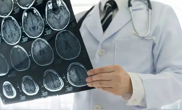 بهترین دکتر مغز و اعصاب کرج